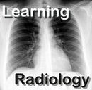 Learning Radiology Video Podcast by William Herring