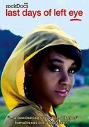 The Last Days of Left Eye