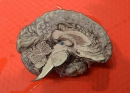 Understanding the Brain by Peggy Mason