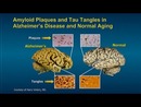 Alzheimer's Prevention Program by Gary Small